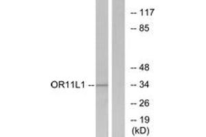 Western blot analysis of extracts from LOVO cells, using OR11L1 Antibody. (OR11L1 anticorps  (AA 201-250))