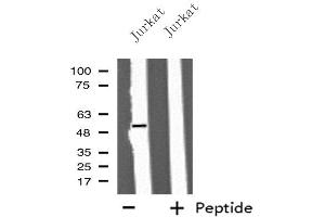 Western blot analysis of extracts from Jurkat cells, using IFIT5 antibody. (IFIT5 anticorps  (Internal Region))