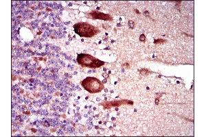 Immunohistochemistry (IHC) image for anti-Kelch-Like ECH-Associated Protein 1 (KEAP1) (AA 380-624) antibody (ABIN1846111)