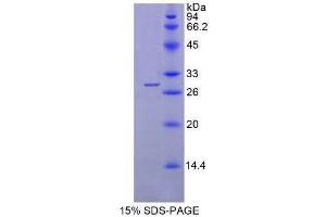 SDS-PAGE (SDS) image for alpha-Fetoprotein (AFP) (AA 399-605) protein (His tag) (ABIN1098835)