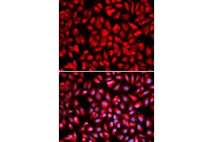 Immunofluorescence analysis of U2OS cells using IPO5 antibody (ABIN5971032). (Importin 5 anticorps)