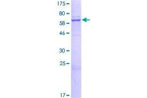 Image no. 1 for ELMO/CED-12 Domain Containing 1 (ELMOD1) (AA 1-334) protein (GST tag) (ABIN1352718)