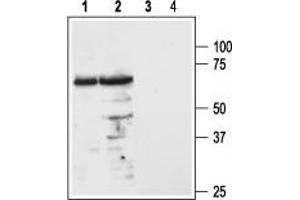 Western blot analysis of mouse (lanes 1 and 3) and rat (lanes 2 and 4) brain lysates: - 1,2. (MC3R anticorps  (1st Extracellular Loop))