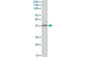 BAG1 monoclonal antibody (M02), clone 2D3.