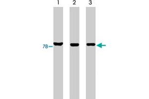 Western blot analysis using MARK3 polyclonal antibody on His-tagged c-tak1 (lane 1), RKO cell lysate (lane 2) and HCT-116 cell lysate (lane 3). (MARK3 anticorps)