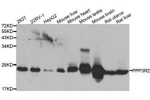 Western blot analysis of extracts of various cell lines, using PPP3R2 antibody. (Calcineurin B anticorps  (AA 1-173))