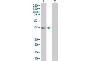 Lane 1: CISH transfected lysate ( 28. (CISH 293T Cell Transient Overexpression Lysate(Denatured))
