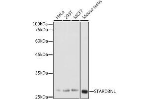 Western blot analysis of extracts of various cell lines, using STNL antibody (ABIN7270585) at 1:1000 dilution. (STARD3NL anticorps  (AA 185-234))