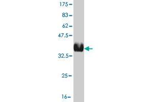 Western Blot detection against Immunogen (36. (Recoverin anticorps  (AA 101-199))