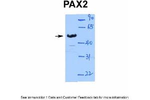 WB Suggested Anti-PAX2 Antibody Titration: 1. (PAX2A anticorps  (Middle Region))