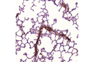 IHC testing of FFPE human lung tissue with C-Reactive Protein antibody at 2ug/ml. (CRP anticorps  (AA 20-230))