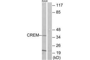 Western blot analysis of extracts from K562 cells, using CREM antibody. (CREM anticorps)