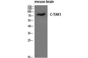 Western Blot (WB) analysis of specific cells using C-TAK1 Polyclonal Antibody. (MARK3 anticorps  (N-Term))