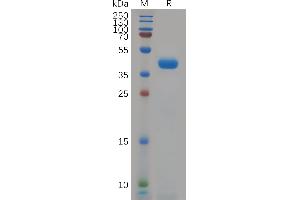 Human K Protein, hFc Tag on SDS-PAGE under reducing condition.