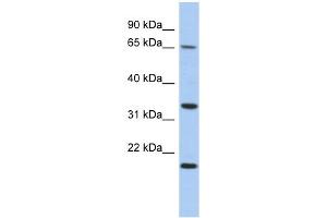 WB Suggested Anti-FAM79B Antibody Titration: 0. (TPRG1 anticorps  (N-Term))
