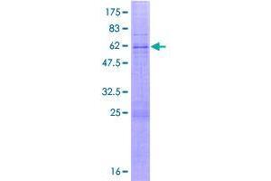 Image no. 1 for SLX1 Structure-Specific Endonuclease Subunit Homolog B (SLX1B) (AA 1-275) protein (GST tag) (ABIN1355129)