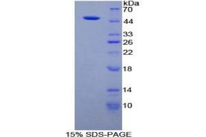 SDS-PAGE of Protein Standard from the Kit (Highly purified E. (Fibrillin 1 Kit CLIA)