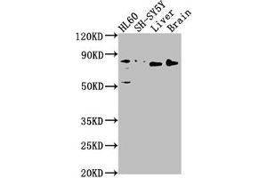 Western Blot Positive WB detected in: HL60 whole cell lysate, SH-SY5Y whole cell lysate, Rat liver tissue, Rat brain tissue All lanes: DNAJC10 antibody at 1:1000 Secondary Goat polyclonal to rabbit IgG at 1/50000 dilution Predicted band size: 92, 87, 38 kDa Observed band size: 80 kDa (DNAJC1 anticorps  (AA 521-793))