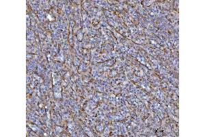 IHC analysis of SAV1 using anti-SAV1 antibody (ABIN7602478). (SAV1 anticorps  (AA 8-320))
