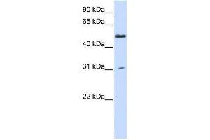 AGXT2L2 antibody used at 0. (AGXT2L2 anticorps  (N-Term))