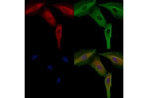 ABIN6264545 and ABIN6272404 staining  cells by IF/ICC. (SIK3 anticorps  (Internal Region))