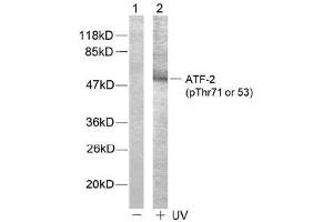 Image no. 2 for anti-Activating Transcription Factor 2 (ATF2) (pThr53), (pThr71) antibody (ABIN196666) (ATF2 anticorps  (pThr53, pThr71))