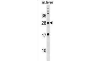 Western Blotting (WB) image for anti-Myelin Protein Zero-Like 3 (MPZL3) antibody (ABIN3000006) (MPZL3 anticorps)