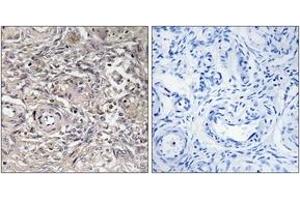 Immunohistochemistry analysis of paraffin-embedded human ovary tissue, using CLDN6 Antibody. (Claudin 6 anticorps  (AA 81-130))