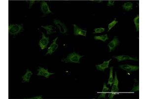 Immunofluorescence of monoclonal antibody to STK3 on HeLa cell.