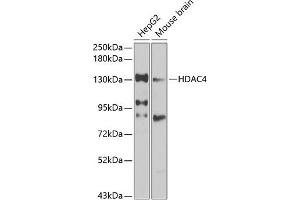 Western blot analysis of extracts of various cell lines, using HD antibody (ABIN6128012, ABIN6141669, ABIN6141672 and ABIN6213648) at 1:1000 dilution. (HDAC4 anticorps  (AA 451-650))