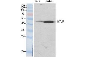 Western Blot (WB) analysis of specific cells using MYLIP Polyclonal Antibody.