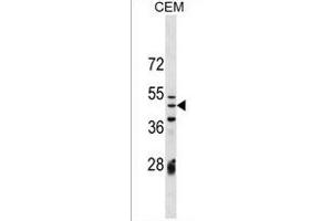 IZUM1 Antibody (N-term) (ABIN1539597 and ABIN2849689) western blot analysis in CEM cell line lysates (35 μg/lane).