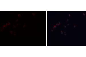ABIN6277808 staining A-431 cells by ICC/IF. (PLIN1 anticorps  (C-Term))