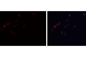 ABIN6277808 staining A-431 cells by ICC/IF. (PLIN1 anticorps  (C-Term))