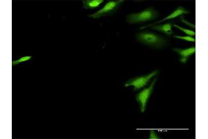 Immunofluorescence of purified MaxPab antibody to UBE2G2 on HeLa cell.