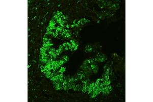 IF analysis of APEX1 using anti-APEX1 antibody (ABIN3043785).