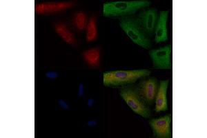 ABIN6258296 and ABIN6274603 staining  cells by IF/ICC. (P-Cadherin anticorps  (N-Term))