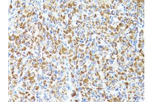 Immunohistochemistry of paraffin-embedded rat ovary using S100A10 antibody. (S100A10 anticorps)