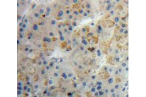 IHC-P analysis of Liver tissue, with DAB staining. (LALBA anticorps  (AA 12-142))