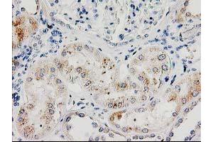 Immunohistochemical staining of paraffin-embedded Human Kidney tissue using anti-ILVBL mouse monoclonal antibody. (ILVBL anticorps)