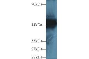 Detection of CK18 in Human Hela cell lysate using Polyclonal Antibody to Cytokeratin 18 (CK18)