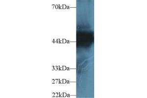 Detection of CK18 in Human Hela cell lysate using Polyclonal Antibody to Cytokeratin 18 (CK18) (Cytokeratin 18 anticorps  (AA 238-396))
