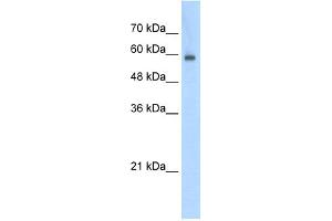 WB Suggested Anti-EIF4G3 Antibody Titration:  0. (EIF4G3 anticorps  (N-Term))