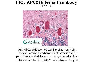 Image no. 1 for anti-APC Regulator of WNT Signaling Pathway 2 (APC2) (Internal Region) antibody (ABIN1731845) (APC2 anticorps  (Internal Region))