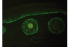 Immunofluorescence image of Collagen type XVII staining in cryosection of murine Skin. (COL17 anticorps)