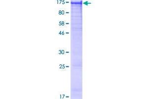 Image no. 1 for Ubiquitin Specific Peptidase 48 (USP48) (AA 1-1035) protein (GST tag) (ABIN1324823)