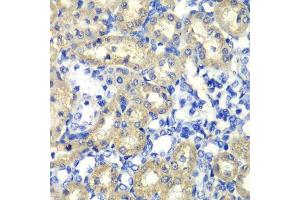 Immunohistochemistry of paraffin-embedded rat kidney using ABAT antibody.