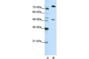 Western Blotting (WB) image for anti-Sjogren Syndrome Antigen B (SSB) antibody (ABIN2462144) (SSB anticorps)