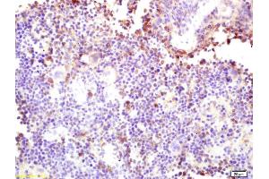 Formalin-fixed and paraffin embedded mouse spleen labeled with Rabbit Anti CARD4 Polyclonal Antibody, Unconjugated (ABIN872332) at 1:200 followed by conjugation to the secondary antibody and DAB staining