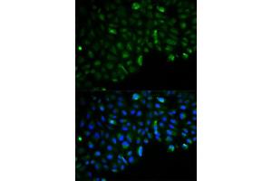 Immunofluorescence analysis of U2OS cells using HK2 antibody.